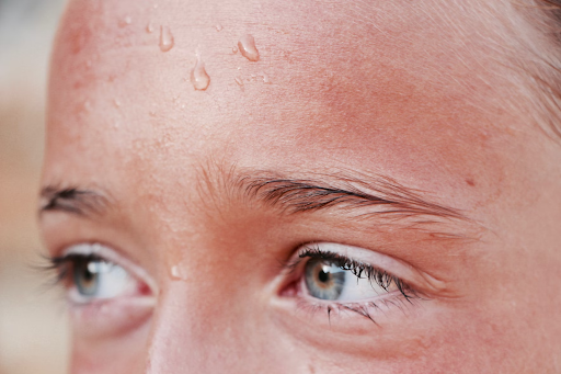 How to Stop Sweating Naturally: The Best Ways to Cure Hyperhidrosis
